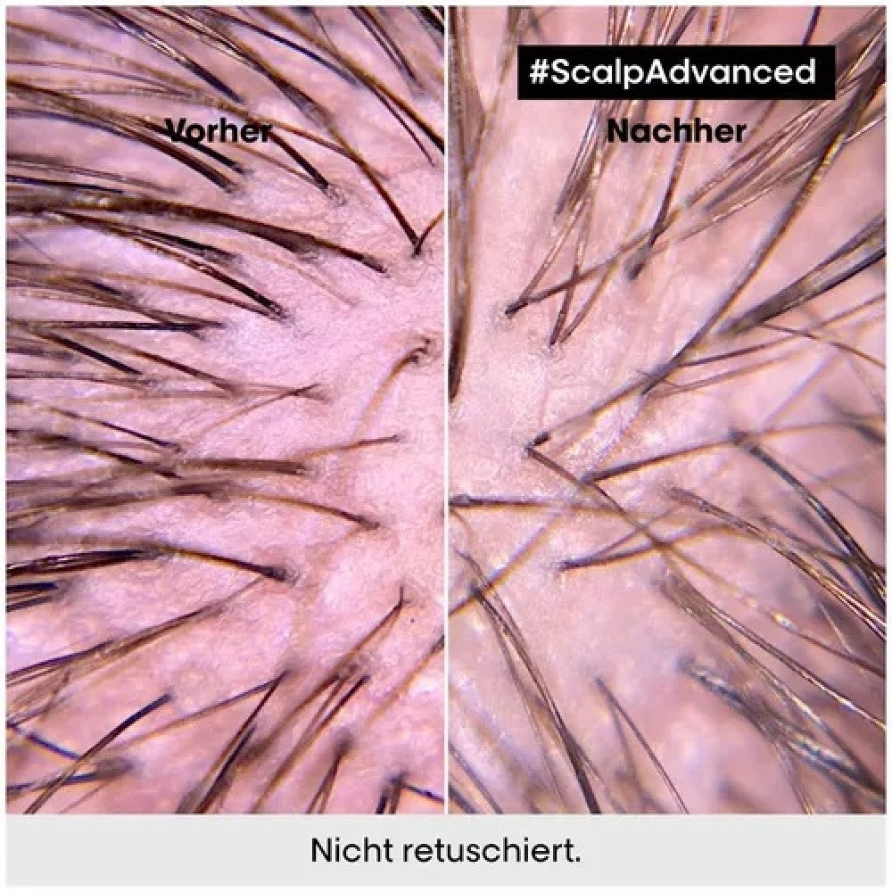 L'Oréal Professionnel Paris Série Expert Aminexil Sérum Activateur Anti-Chute Avancé 90 ml