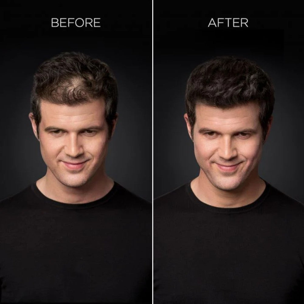 Toppik Hair Fibres 27,5 g Black